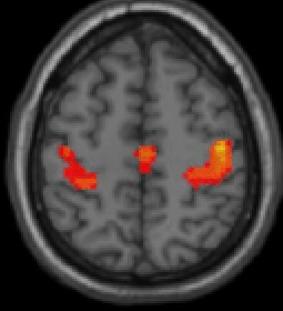 Pasted image 20260606014831.png